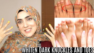 HOW TO BRIGHTEN HANDSFEET AND LIGHTEN KNUCKLESTOES IN URDU STEP BY STEP ROUTINE Immy [upl. by Irv271]