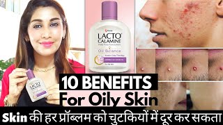 10 Uses of Lacto Calamine Lotion for Pimples Oily Skin Blackheads Acne Prone skin  Dr Menka [upl. by Bodkin]