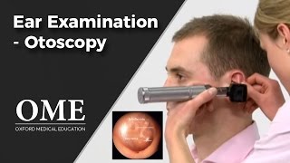 Otoscopy Ear Examination  ENT [upl. by Olivann]