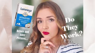 Lumineux Whitening Strips  Honest Review [upl. by Lorrin63]