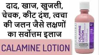 Calamine lotion  Superb remedy for mild skin infections [upl. by Genaro]