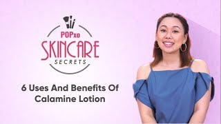 6 Uses And Benefits Of Calamine Lotion  POPxo Skincare Secrets [upl. by Eniak]