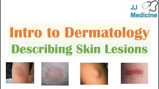 Introduction to Dermatology  The Basics  Describing Skin Lesions Primary amp Secondary Morphology [upl. by Merchant]