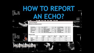 HOW TO BUILD YOUR ECHO REPORT  Echocardiogram [upl. by Ydnak]