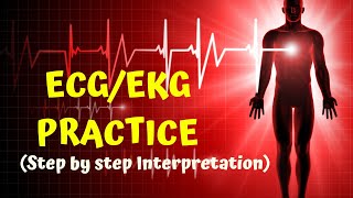 HOW TO READ AN ECG in 10 mins part2   ECG  EKG PRACTICE [upl. by Noonberg]