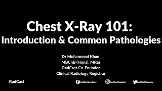 RadCast Academy Introduction To The Chest XRay amp Common Pathologies cxr radcast [upl. by Eidob]