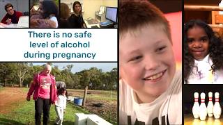 FASD in Australia [upl. by Marjie]