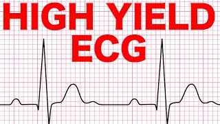 Electrocardiograms ECG Made Easy [upl. by Esimehc]