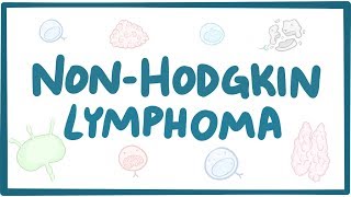 Nonhodgkin lymphoma  causes symptoms diagnosis treatment pathology [upl. by Romanas]