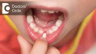 Why do childrens teeth fall out  Dr Raju Srinivas [upl. by Nim]