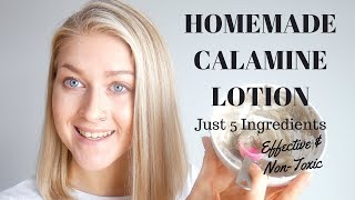 5 Ingredient DIY Calamine Lotion amp Powder  Homemade Calamine Lotion [upl. by Lyndon]