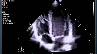 Understanding Echo Standard Imaging Views [upl. by Virge]